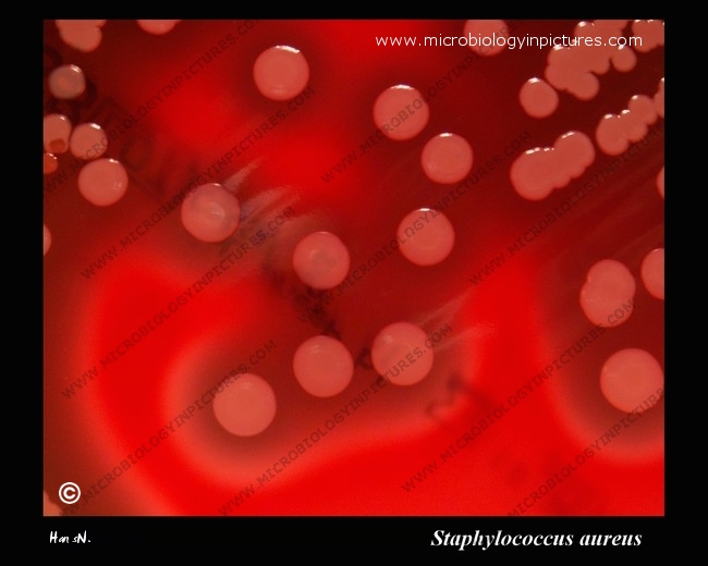 s.aureus beta-hemolysis
